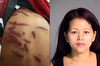 (LEFT) Some of the wounds suffered by the 7-year-old boy. Image is evidence filed in Marion (Ind.) Superior Court via The Indianapolis Star (RIGHT) Kin Park Thaing is suspected of beating her son with a plastic coat hanger. 