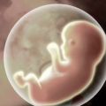 U.S. judge upholds Arizona law banning late-term abortions 